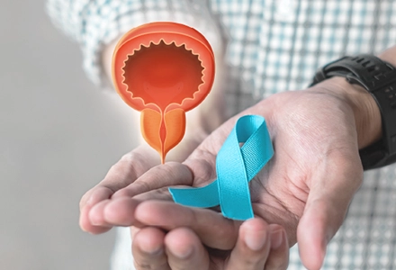 Prostatectomy