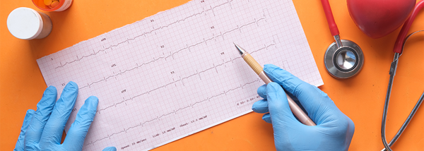 what-ecg-role-does-it-play-v1