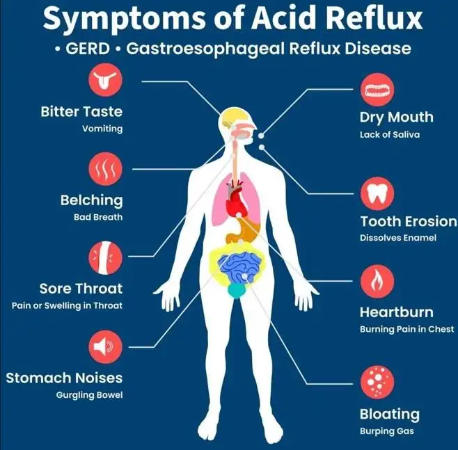 BEYOND THE BURN UNDERSTANDING ACID REFLUX-3