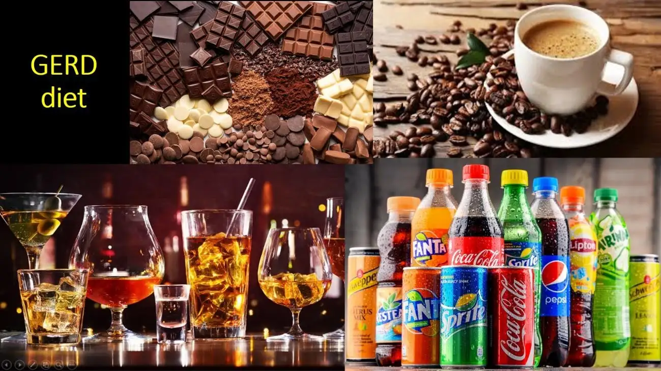 BEYOND THE BURN UNDERSTANDING ACID REFLUX-4