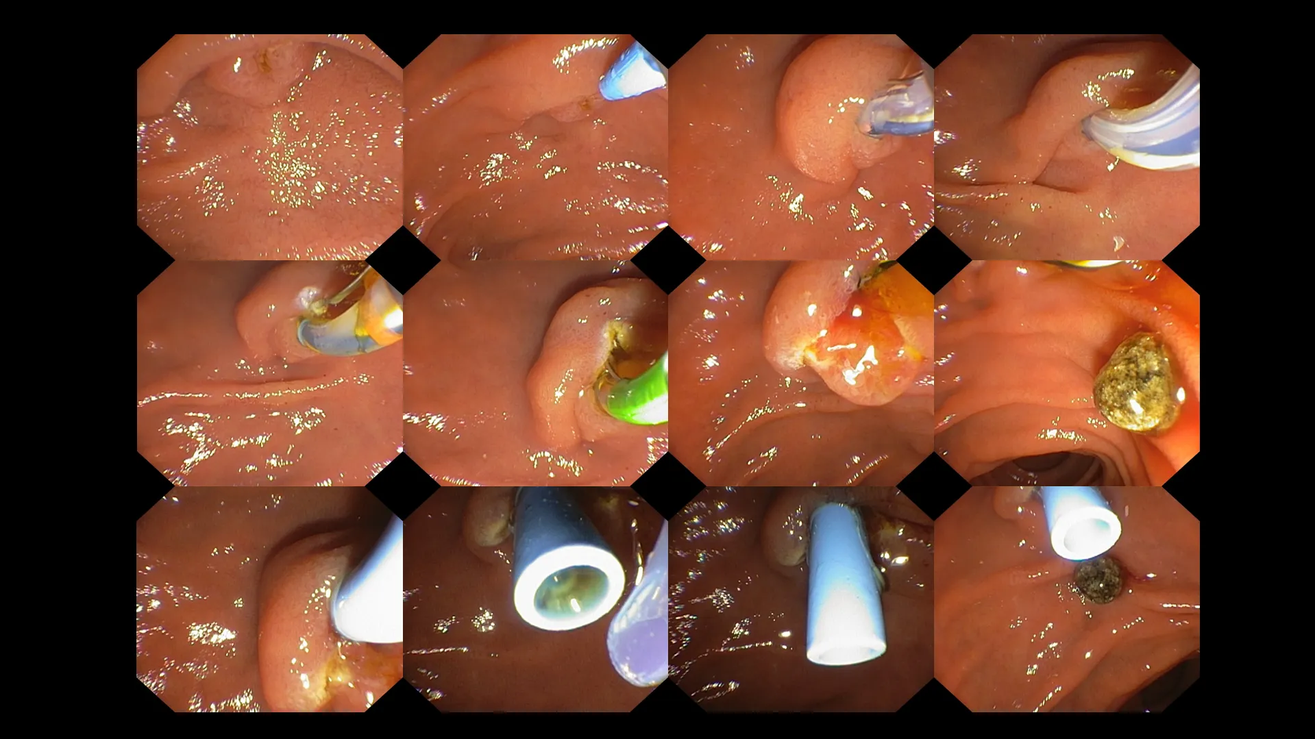 GONE BUT NOT FORGOTTEN 11