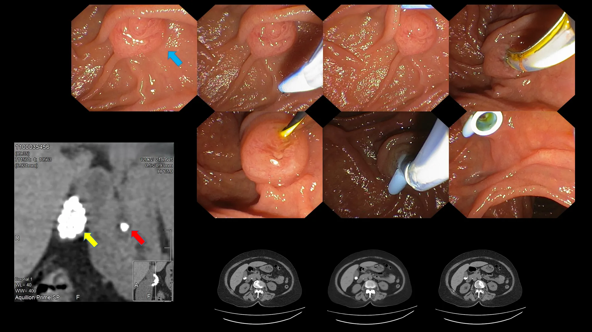 GONE BUT NOT FORGOTTEN 12