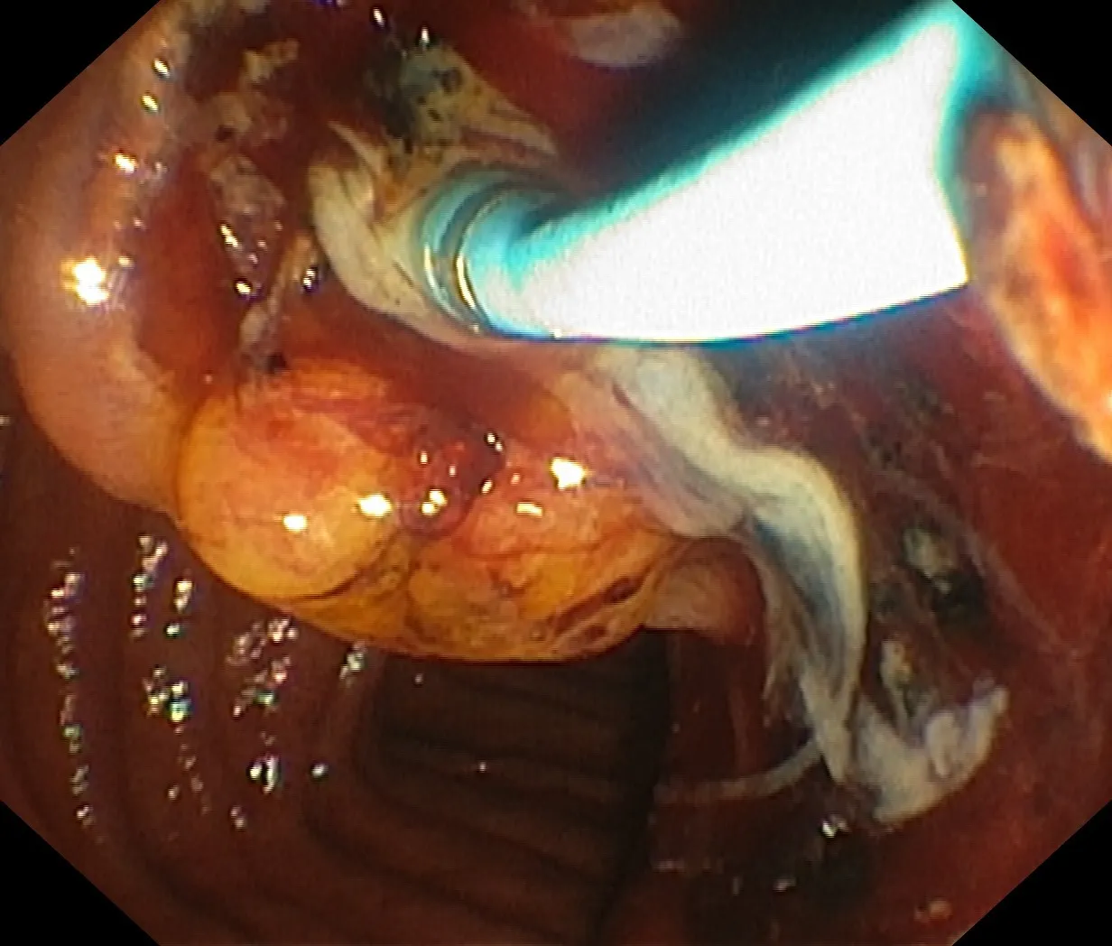 GONE BUT NOT FORGOTTEN 13