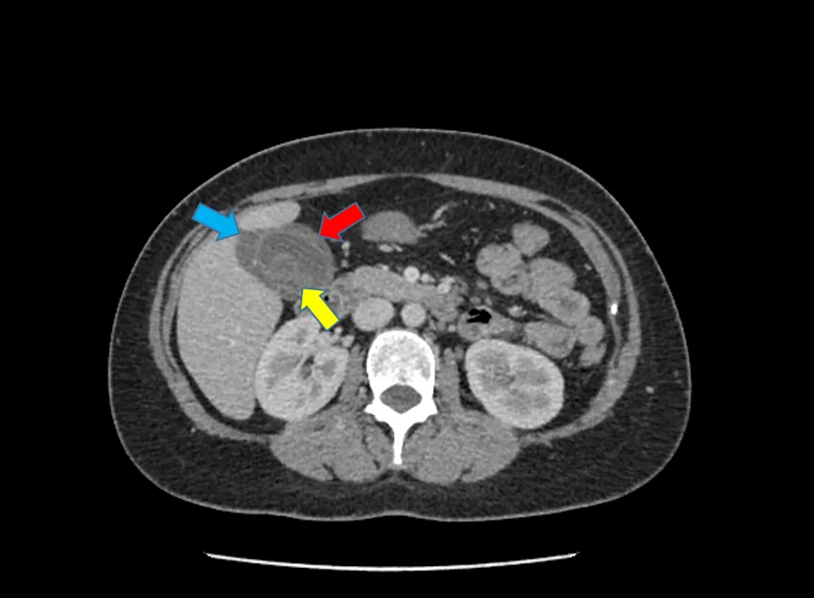 GONE BUT NOT FORGOTTEN 9