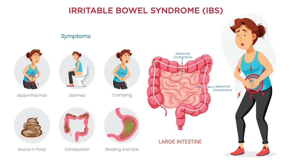 IRRITABLE BOWEL SYNDROME 6