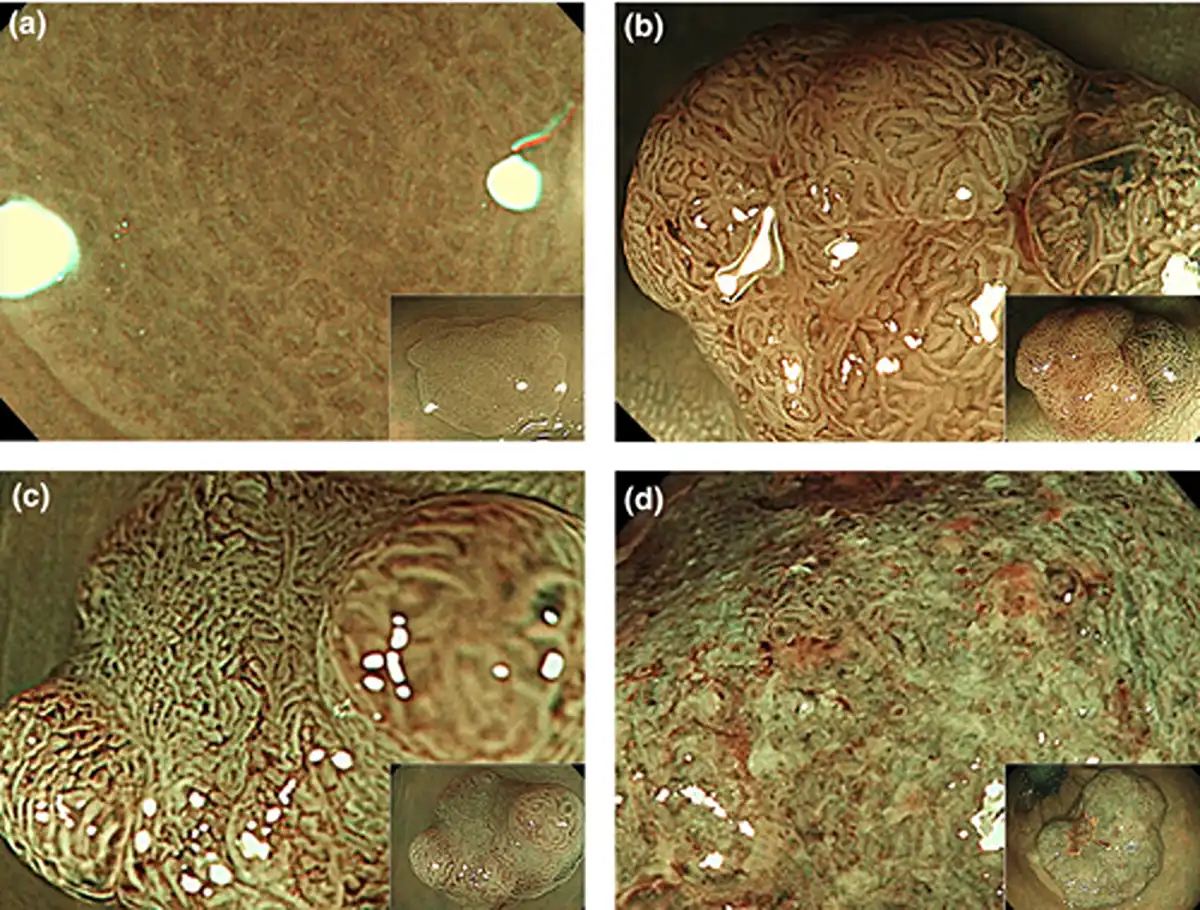 Standardized classification.2 image