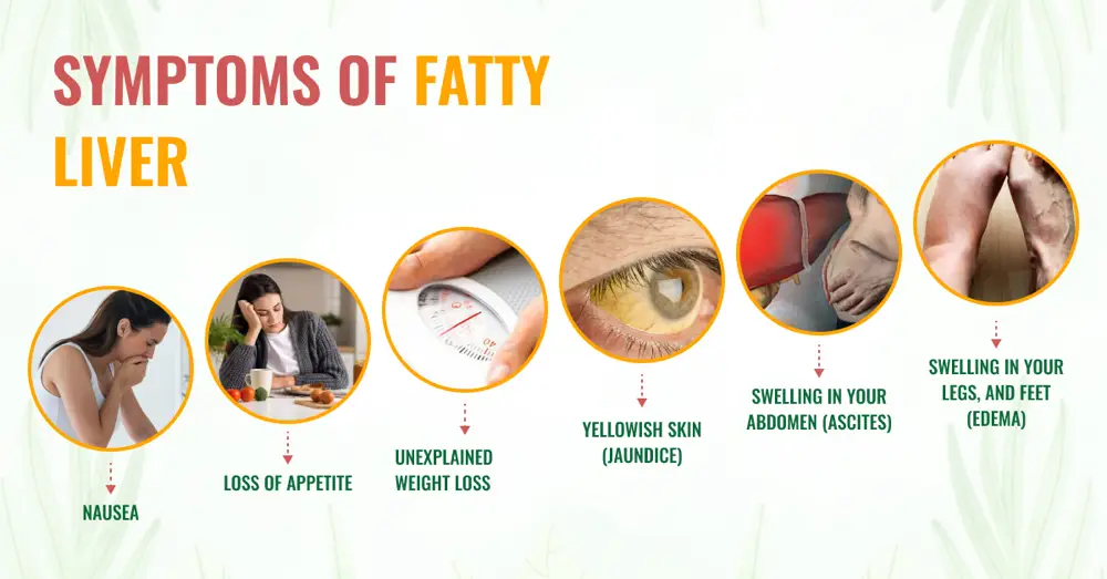 UNDERSTANDING FATTY LIVER DISEASE7