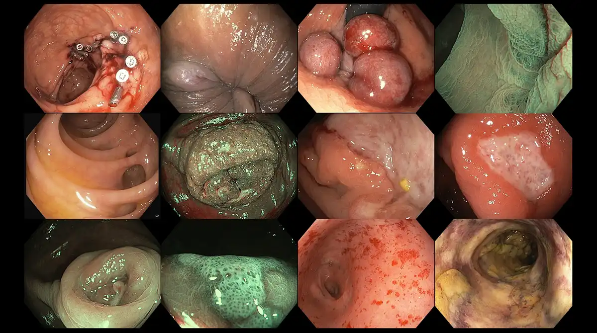 Various non-malignant image